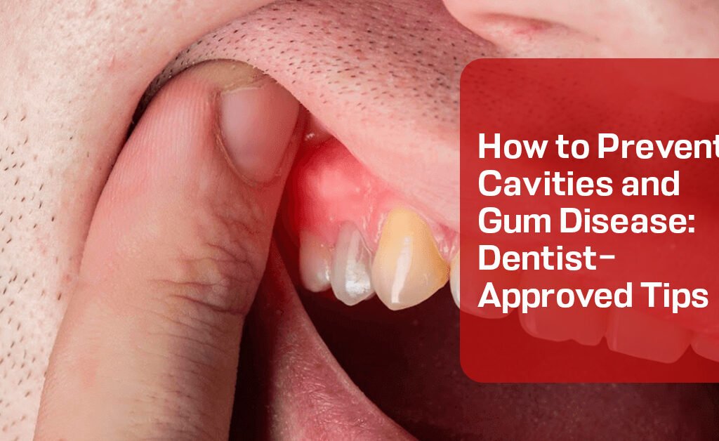 Prevent Cavities and Gum Disease