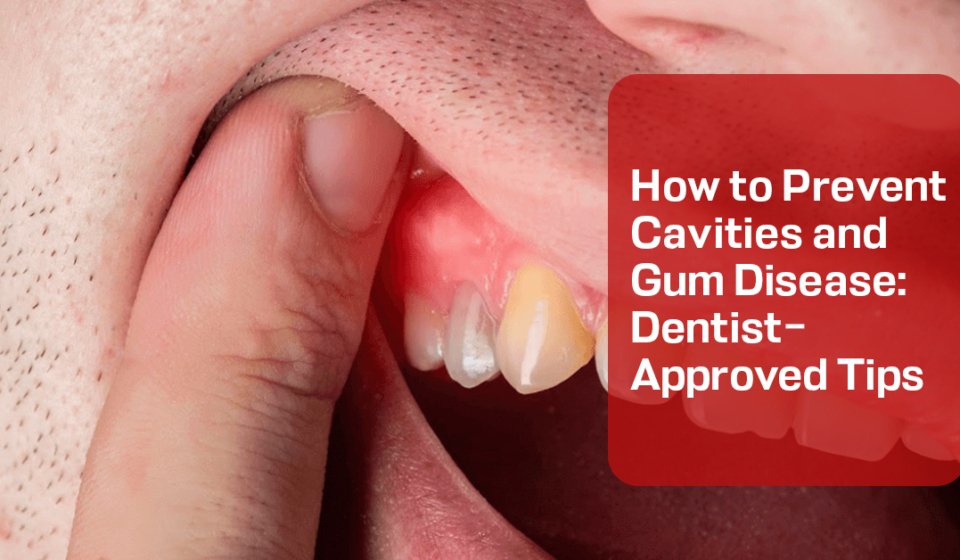 Prevent Cavities and Gum Disease