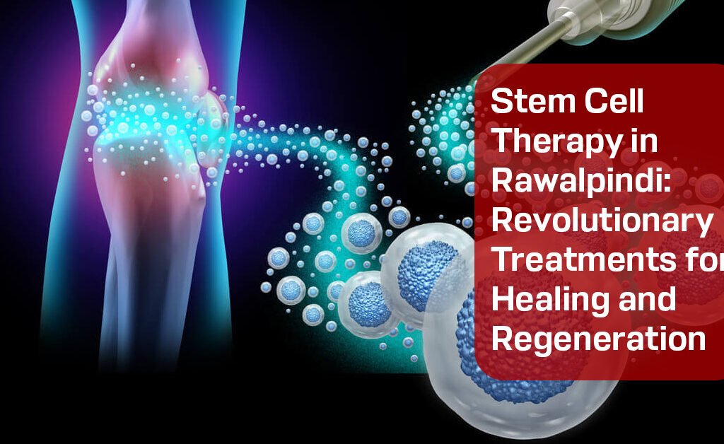 Stem Cell Therapy in Rawalpindi