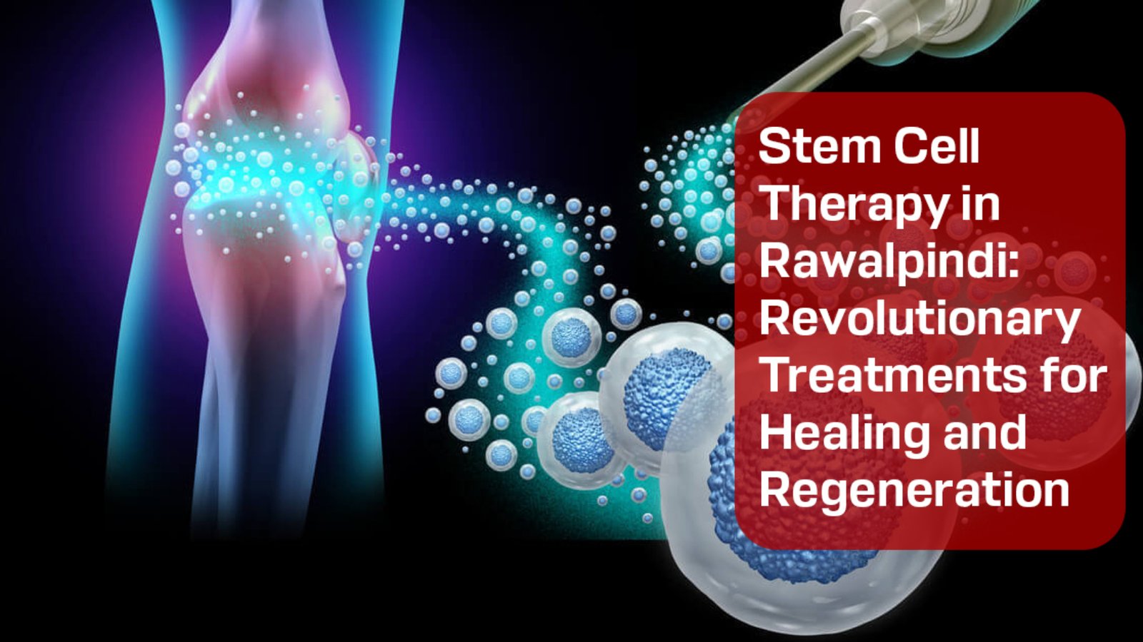 Stem Cell Therapy in Rawalpindi