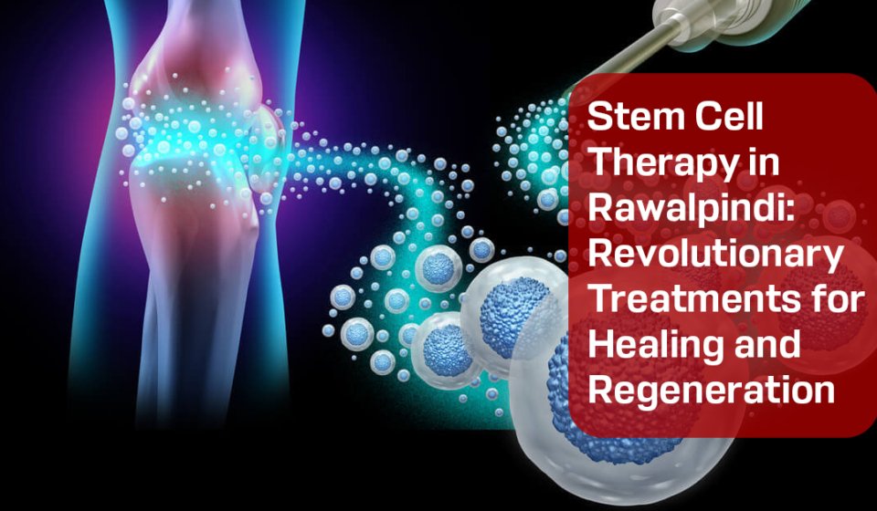 Stem Cell Therapy in Rawalpindi
