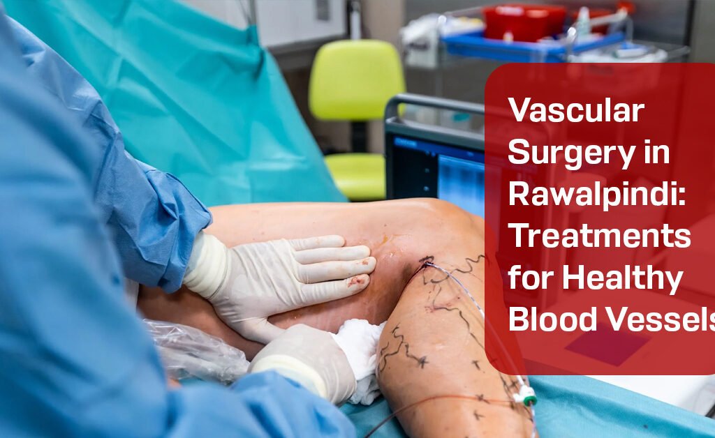 Vascular Surgery in Rawalpindi