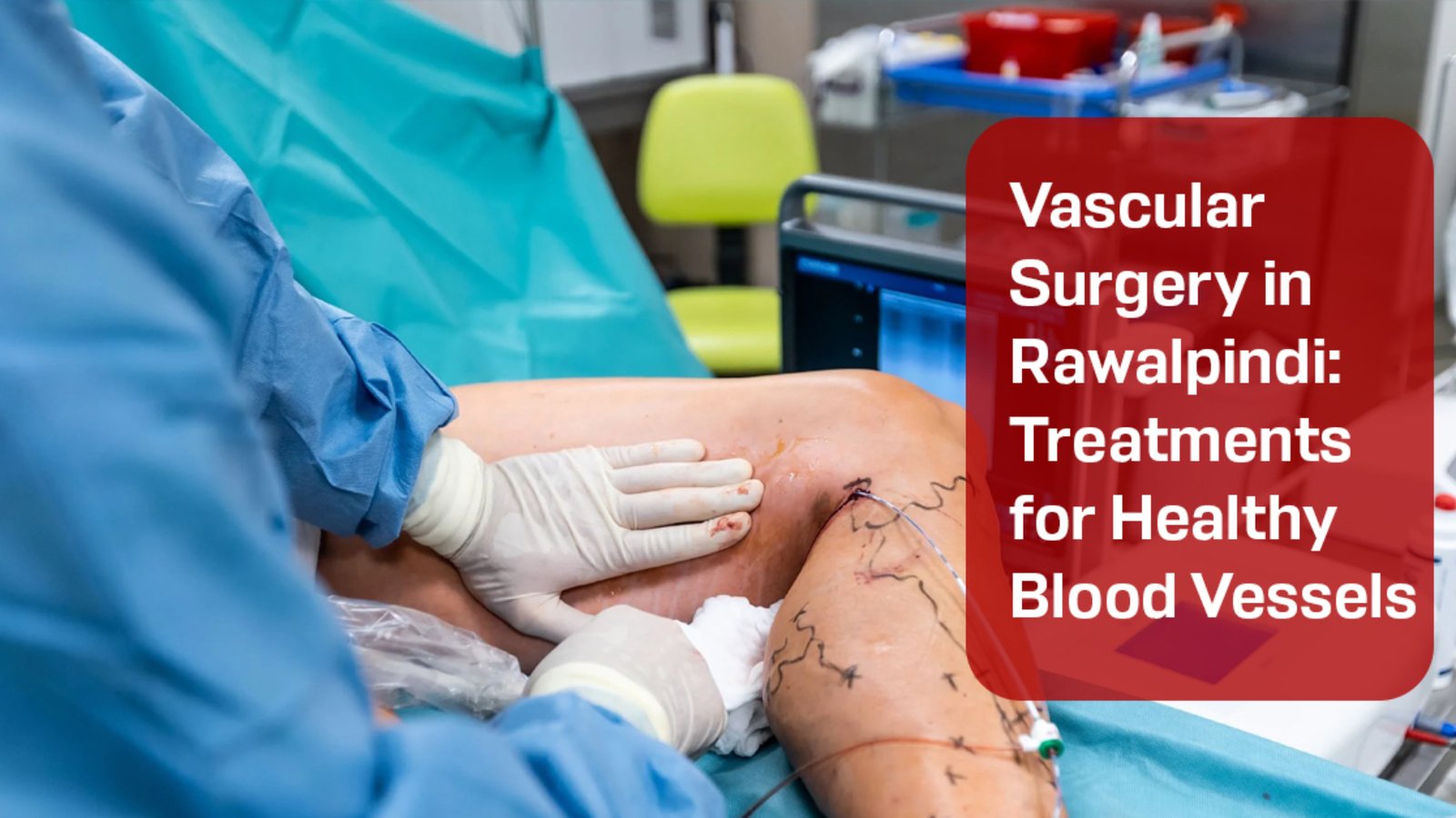 Vascular Surgery in Rawalpindi