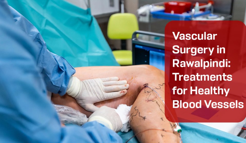 Vascular Surgery in Rawalpindi