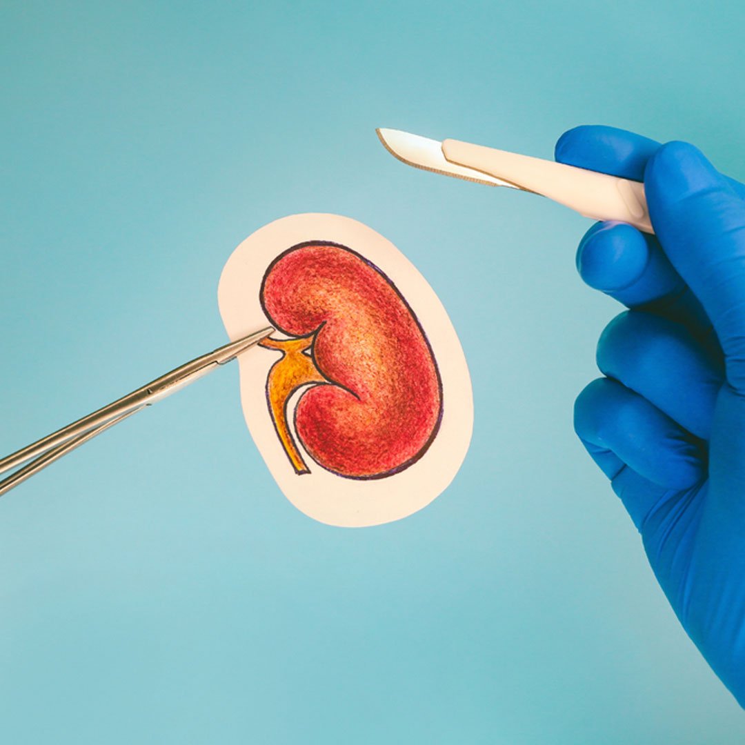 Renal & Surgical Care